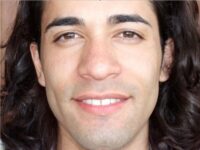 rhinoplasty patient