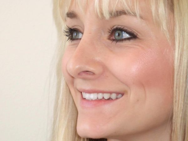 rhinoplasty patient