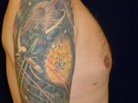 after gynecomastia right side view male patient case 3265