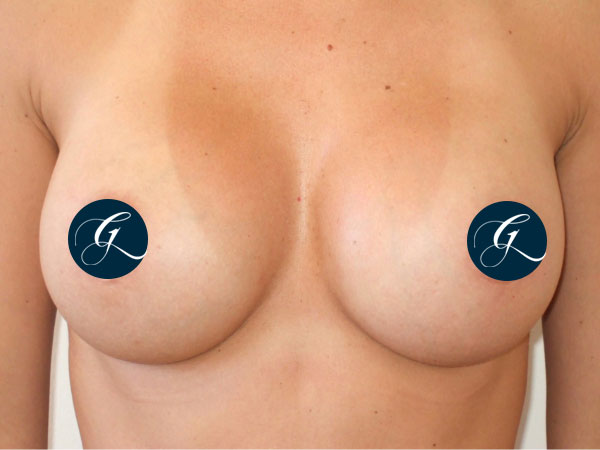 Gray-Banner-breast12