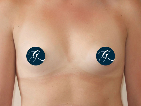 Gray-Banner-breast14