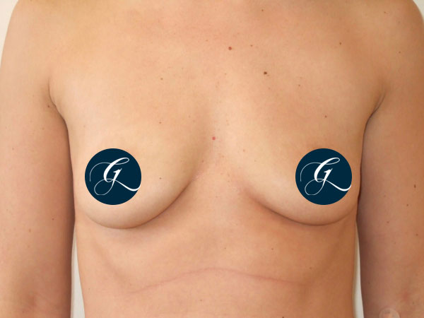 Gray-Banner-breast20